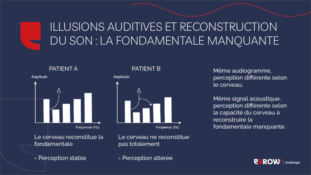 Illusions auditives et reconstruction du son : la fondamentale manquante