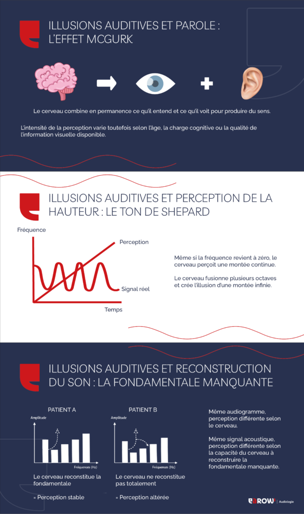 Illusions auditives : quand le cerveau contredit l’audiogramme
